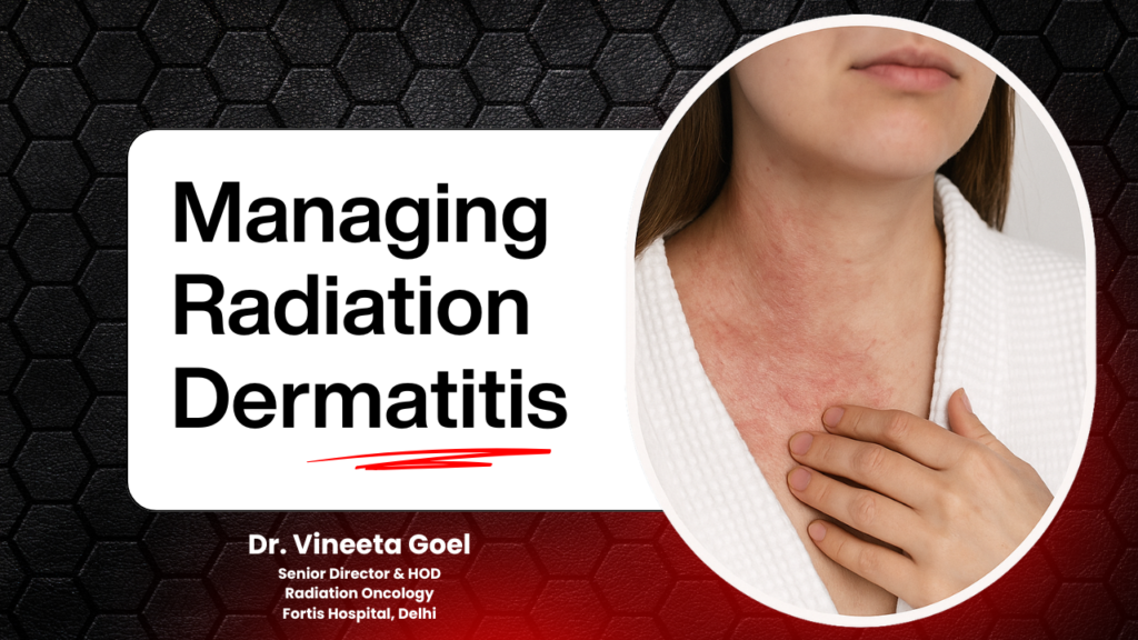radiation dermatitis